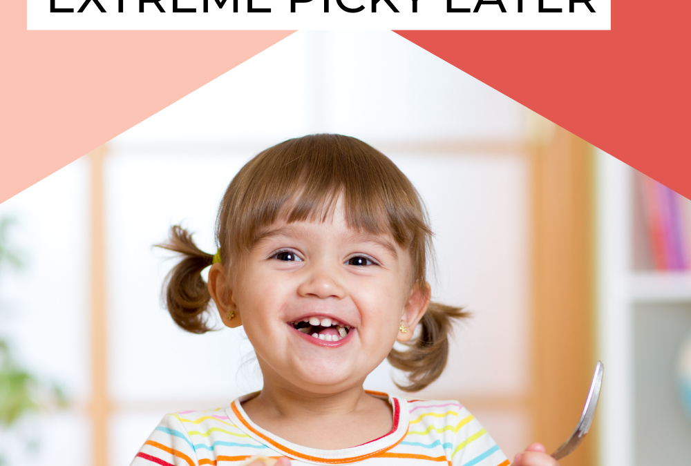 6 Simple Dos and Don’ts for Feeding an Extreme Picky Eater