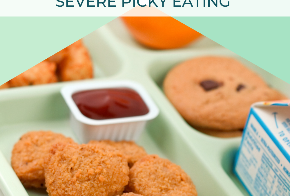 How You Can Stop Feeling Guilty About Your Child’s Severe Picky Eating